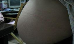 怀孕35周可以吃白瓜吗,白瓜，孕妇的安心之选